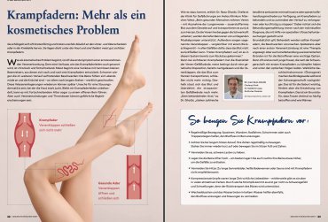 Krampfadern - Mehr als ein kosmetisches Problem | Dr. Reza Ghotbi